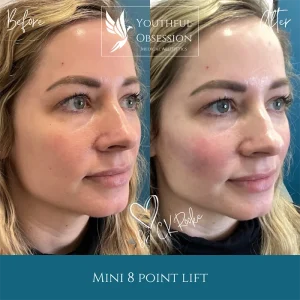 Mini 8 point Lift B&A